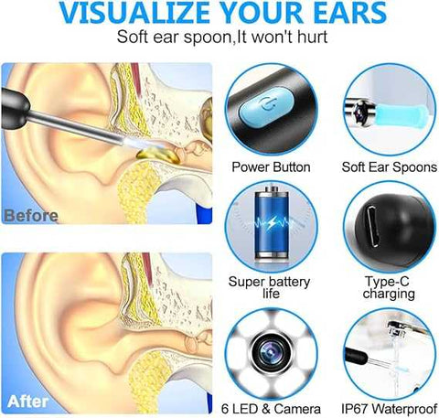 Smart Visual Ear Wax Cleaning Kit with HD Camera